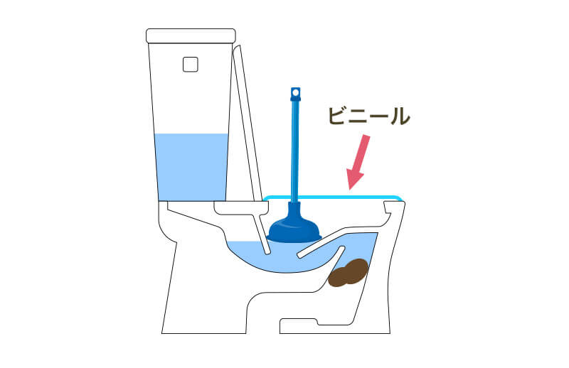 排出物（便）が詰まる